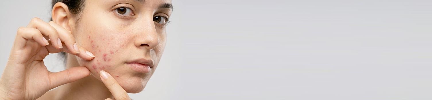 tout savoir sur les huiles de CBD