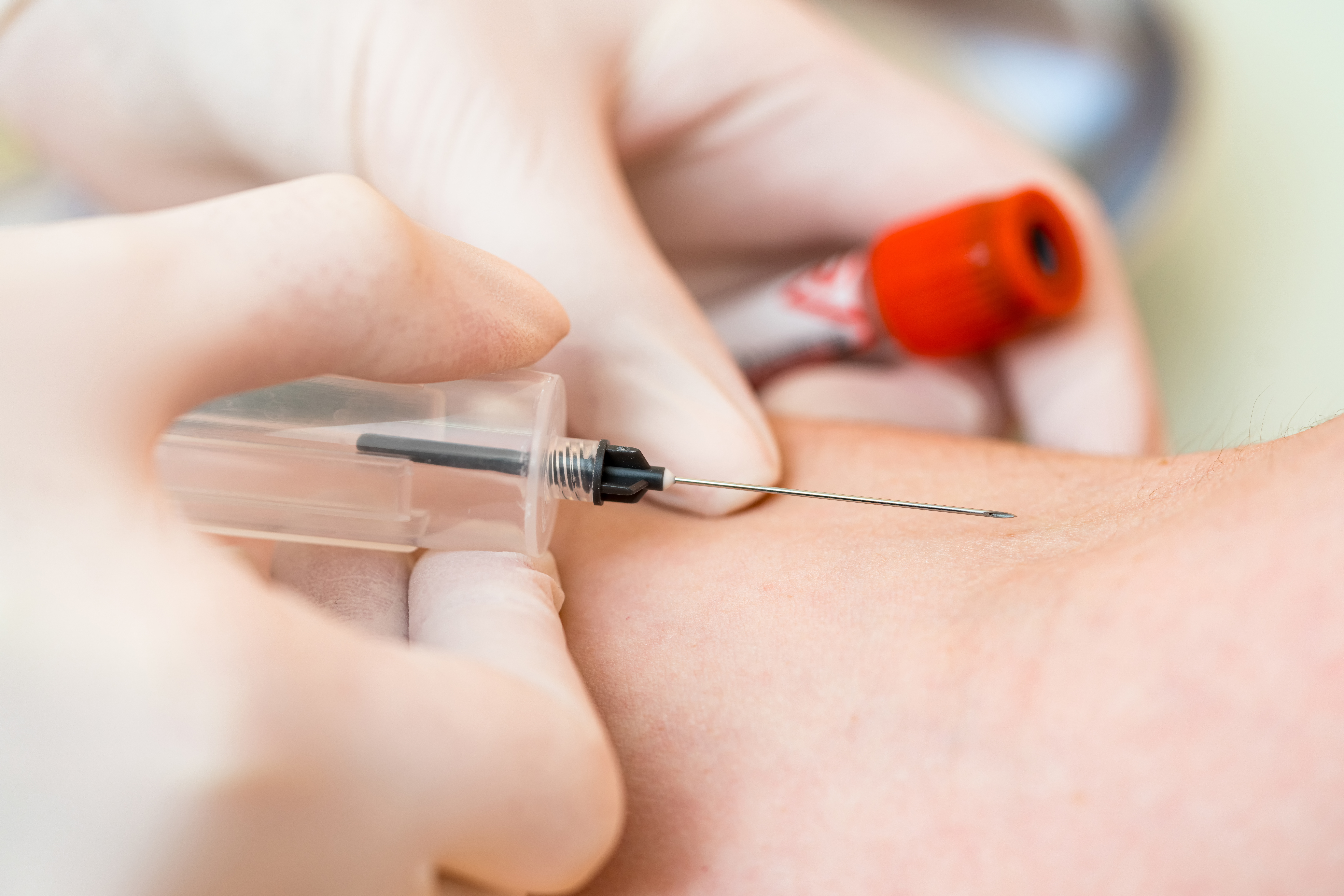 tout savoir sur les huiles de CBD