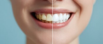 Image de l’article