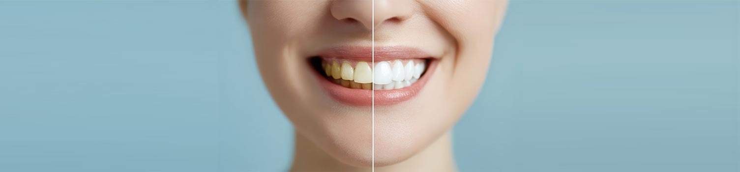 tout savoir sur les huiles de CBD